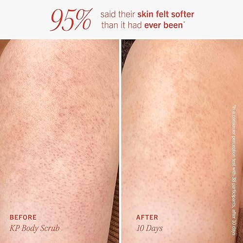 Miniatura 5 de First Aid Beauty Kit corporal suave + liso exfoliante corporal KP Bump Eraser, 4 onzas, loción suavizante + iluminadora (melocotón), 1 onza y