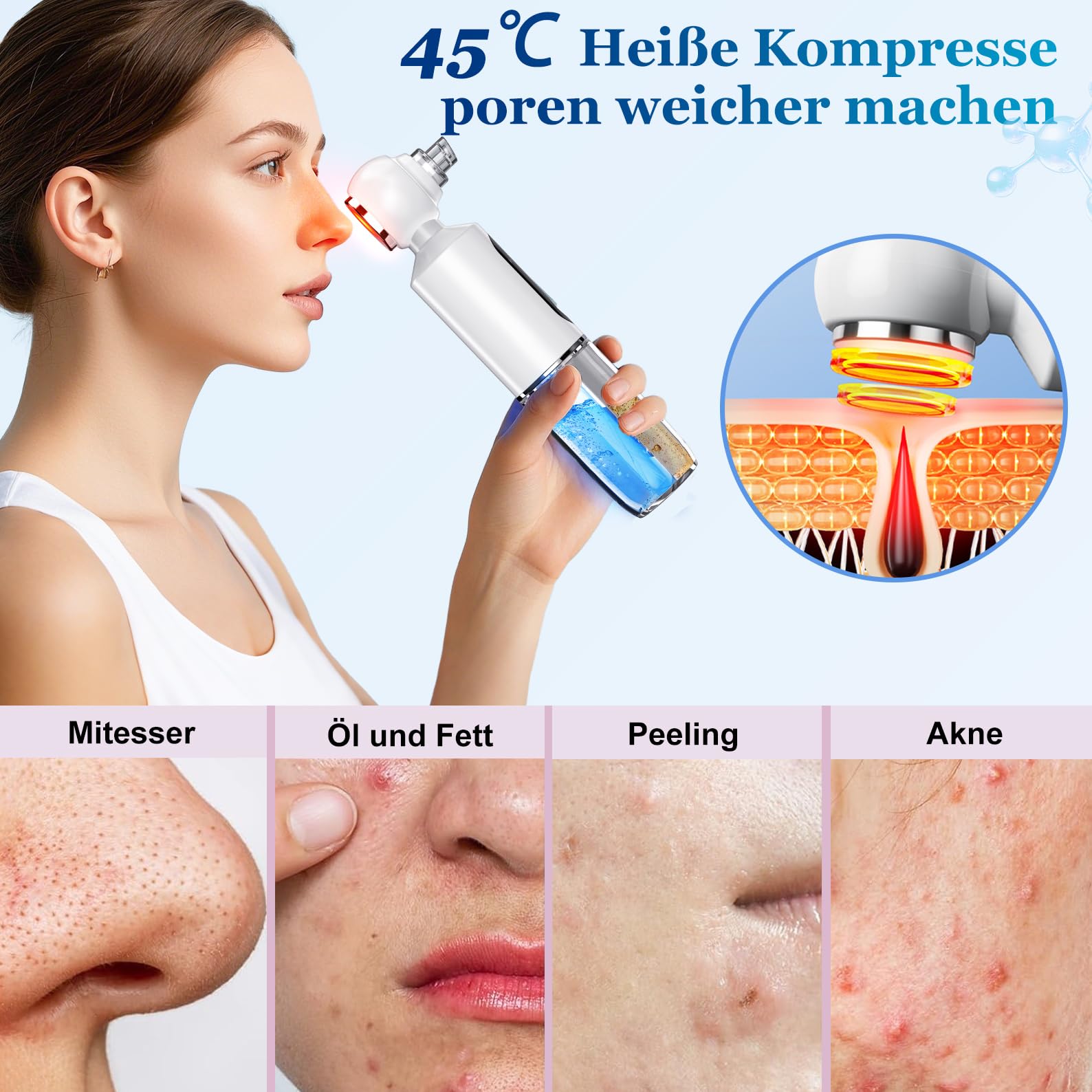 Limpiador de Espinillas y Poros para la Cara, 4 Modos, 6 Puntas de Succión y Depósito de Agua Visible, Diseño Patentado-Compresas Calientes, Limpieza Facial, Tratamiento del Acné, Limpiador de Puntos