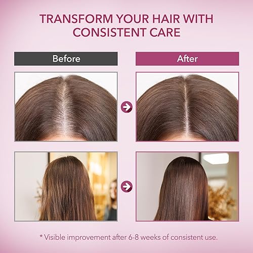 Miniatura 6 de Champú para el crecimiento del cabello con cebolla y romero champú con infusión de biotina para la pérdida y adelgazamiento del cabello - Promueve