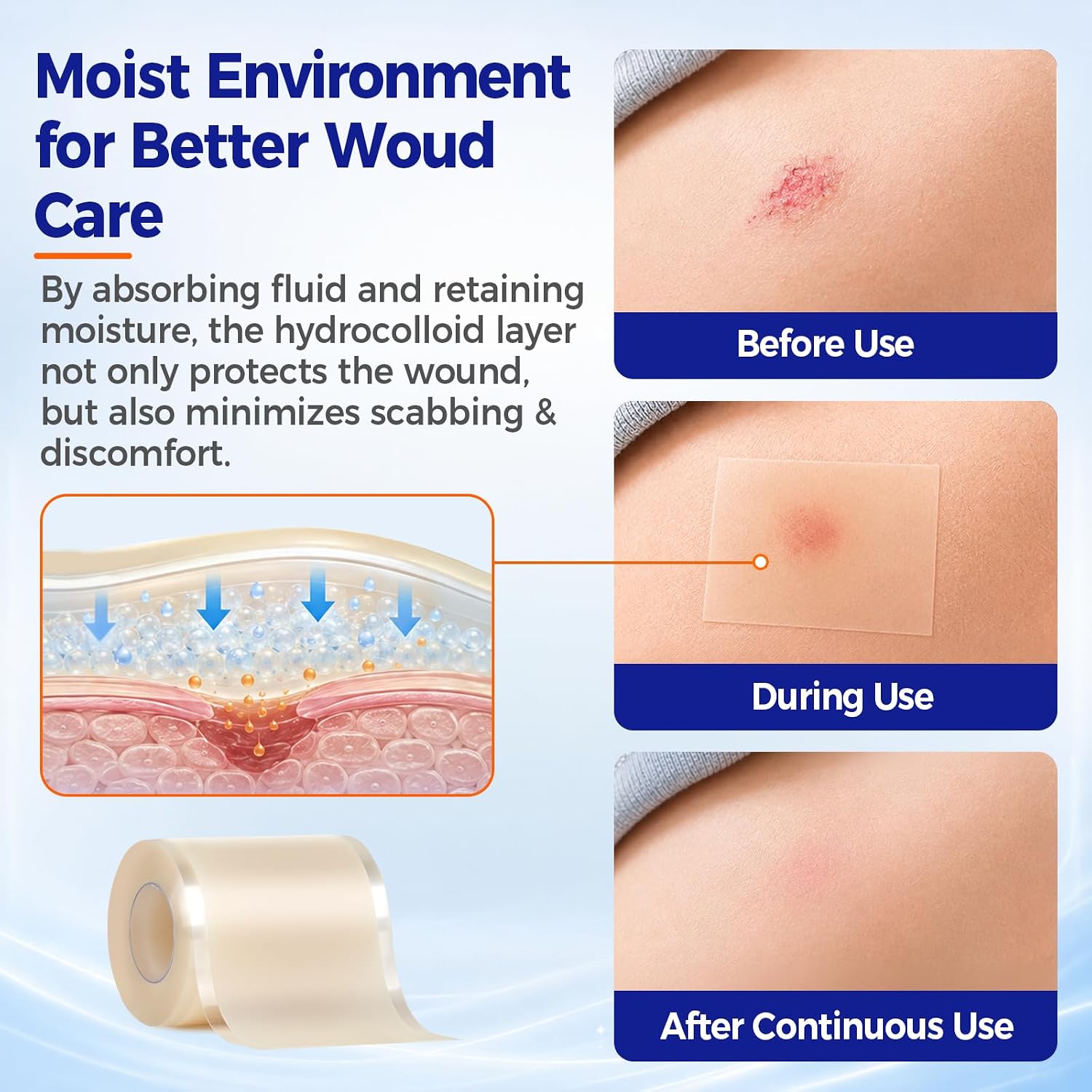 Sterile Hydrocolloid Dressing Roll, Easy-Grip Tabs Hydrocolloid Bandages for Blister Care/Wound Dressing/Acne&Pimple,Waterproof/Self-Adhesive/Cut-to-Size Moist Healing Pimple Patches, First Aid Kit
