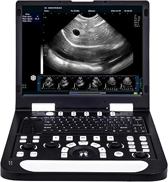 N60 15" LCD Veterinary Ultrasound Machine, PW Function, Carring Bag, Image Video Saving, Case Report Print for Cattle Ranch, Horse Farm Animal Pregnancy Check 4.0 Mhz Convex Rectal Probe