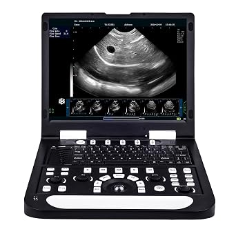 N60 Portable Veterinary Ultrasound Machine, PC-Based Ultrasound Systems, 15" High-Resolution LCD, for Dogs, Cats, Small Animals Disease & Pregnancy Check Linear Array Probe
