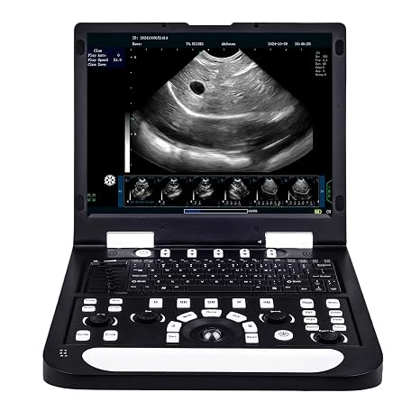 N60 Portable Veterinary Ultrasound Machine, PC-Based Ultrasound Systems, 15 High-Resolution LCD, for Dogs, Cats, and Small Animal Disease & Pregnancy Check (Micro-Convex Probe)