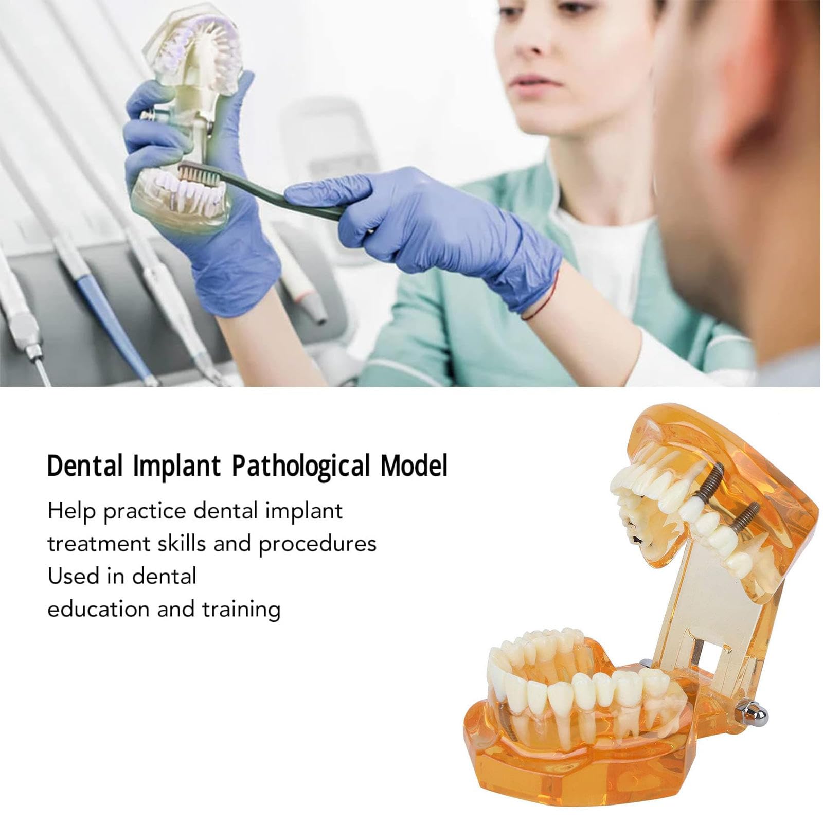 Modello di Insegnamento dello Studio Rimovibile di Malattie Dentali, Modello per Programmi Scolastici di Odontoiatria, Modello di Impianto Dentale, Strumento Dimostrativo