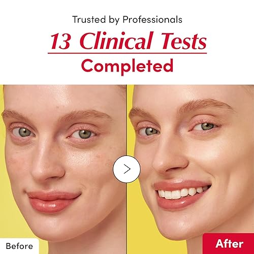 Miniatura 6 de EQQUALBERRY Suero iluminador de vitaminas  Suero iluminador de vitamina C con niacinamida  Fortalece la barrera cutánea  Hidrata con ceramida y