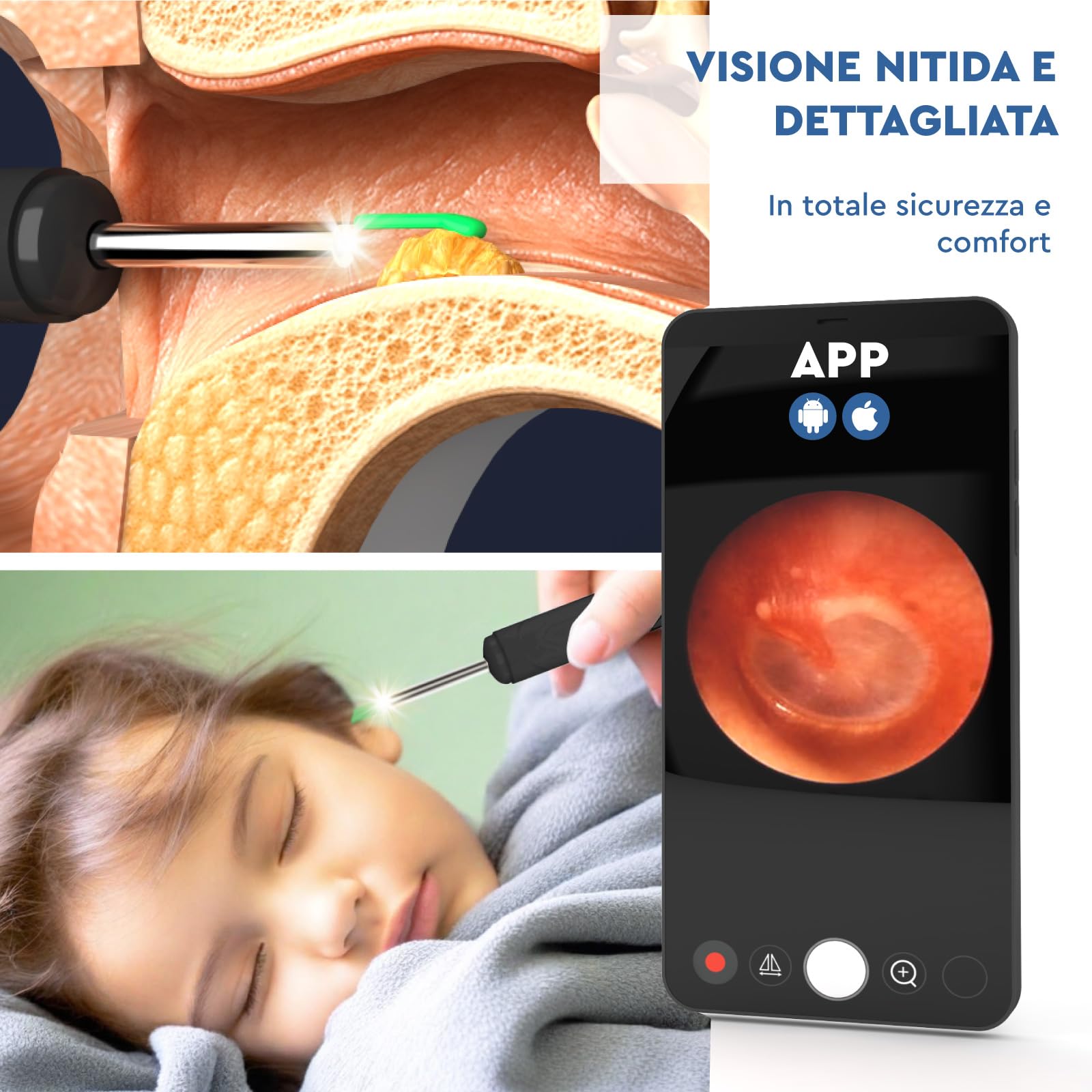 Otoscopio Pulizia Orecchie Rimozione Cerume con Telecamera 1920p WiFi 3,6mm - UdiGuard Pulitore Orecchie Digitale con 6 Luci LED Animali Adulti Bambini - Compatibile con iPhone iPad Android Nero