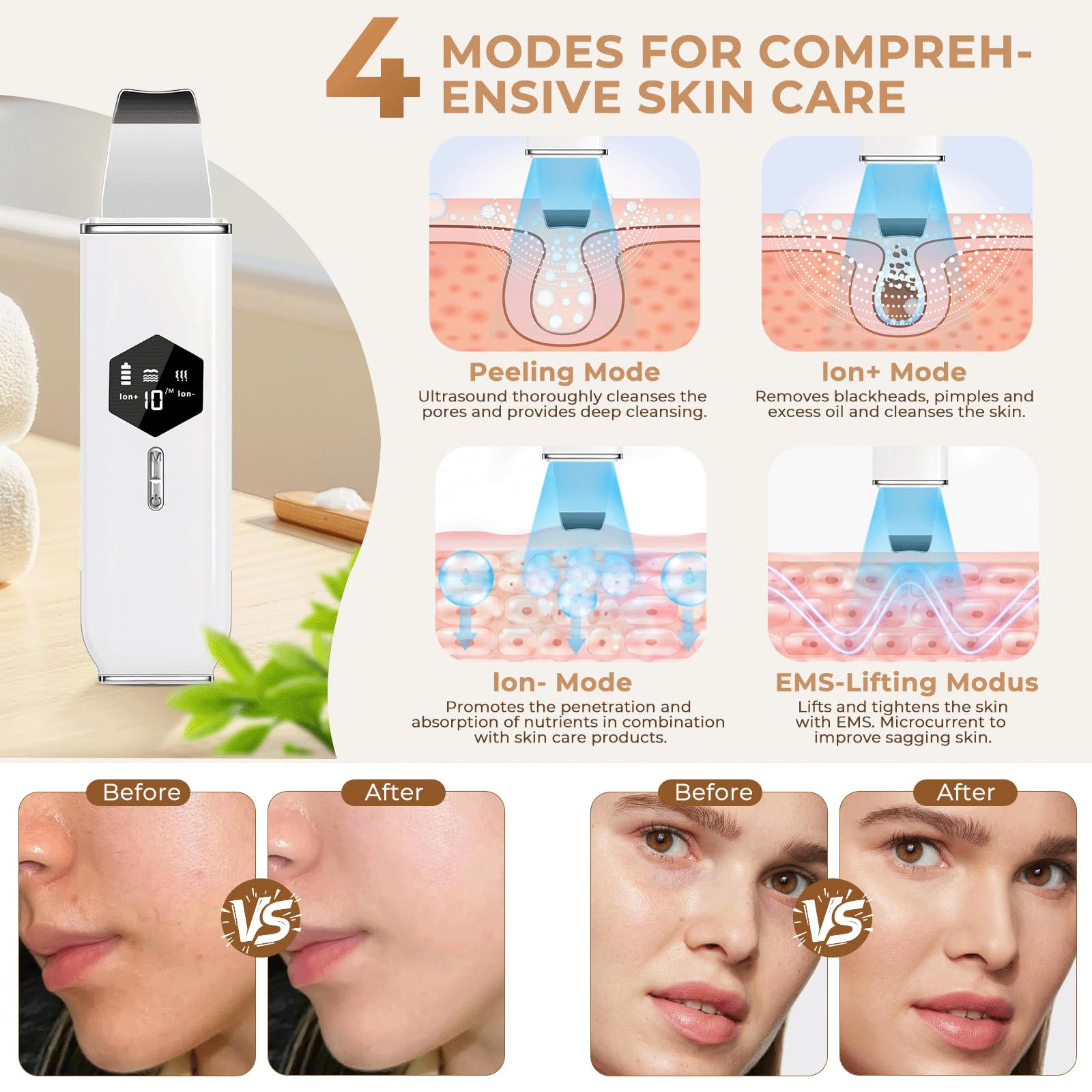 Pulizia Viso Ultrasuoni,Punti neri rimozione,Aspira punti neri,Skin Scrubber,Spatola Ultrasuoni Viso,Peeling Ultrasonico,con 4 Modalità e Intensità Regolabile,per la Pulizia Della Pelle