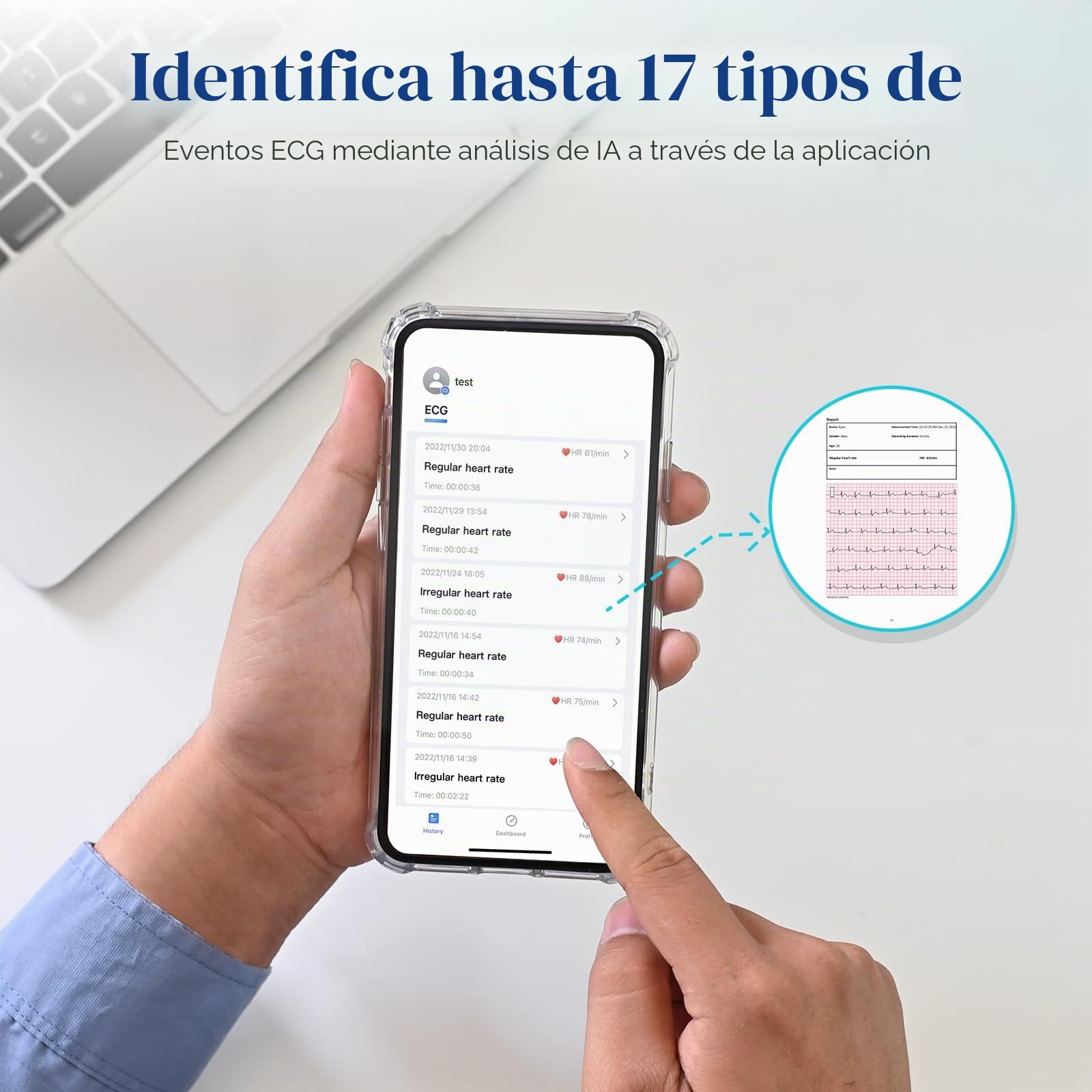 CheckMe ER2-S Electrocardiografo Portatil,para uso Doméstico,Dispositivo de ECG con Banda Pectoral,30s-15min,Almacenamiento de Datos Ilimitado,Pantalla OLED de 0,96 Pulgadas,para iOS y Android