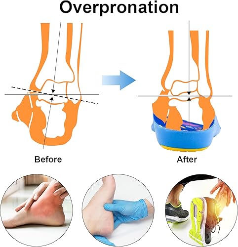 Miniatura 5 de Soporte de arco ortopédico para niños, fascitis plantar, pies planos, insertos de espuma de poliuretano para aliviar el dolor de pies, espalda,