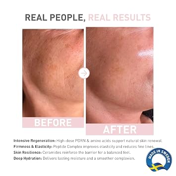 PDRN Salmon DNA Regenerating Serum 1.2% - 1.01 fl. Oz. Hydrating Face Serum with Niacinamide, Peptides & Hyaluronic Acid - Lightweight Moisturizing Serum for Radiant-Looking Skin by Bionnex