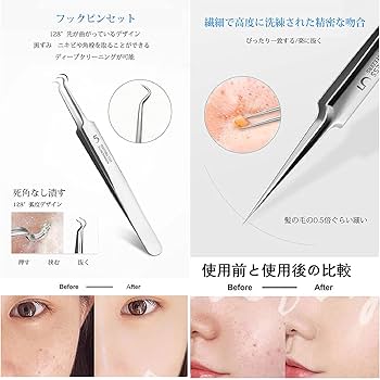 Amazon | ステンレススチールコメドプッシャー、【3セット】スーパー