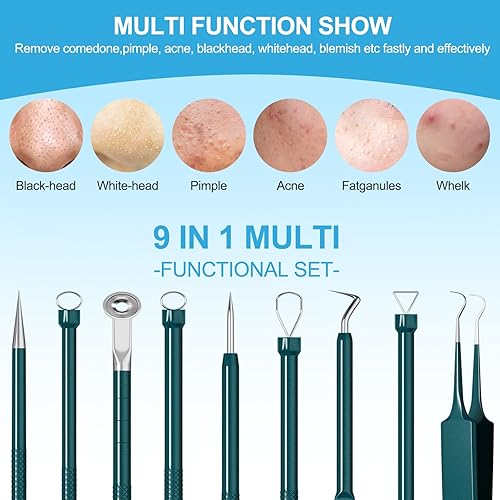 Miniatura 3 de Herramientas para eliminar puntos negros, kit de herramientas para reventar espinillas, kit de eliminación de acné para puntos blancos, manchas,