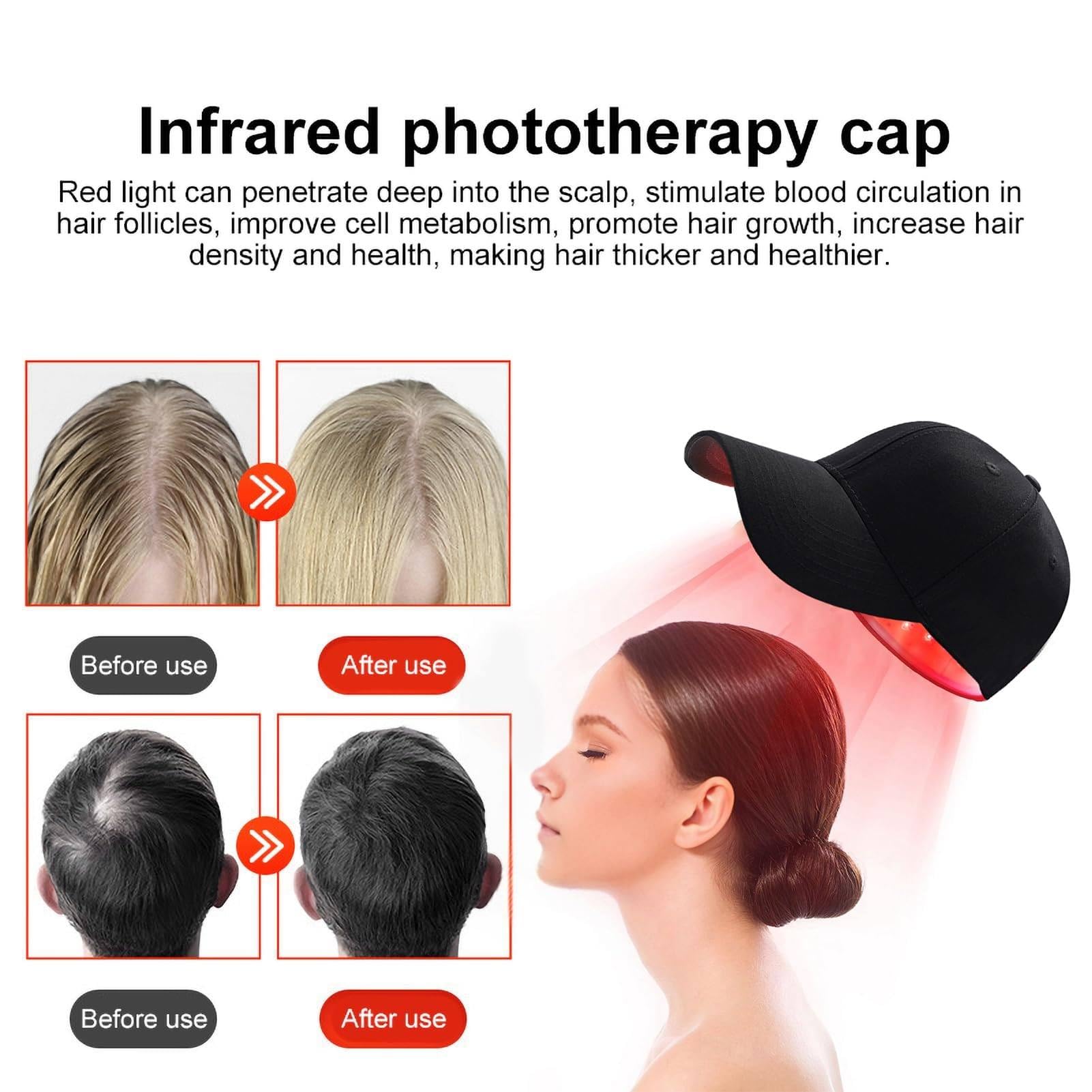 Gorro para El Crecimiento del Cabello (48 Led), Gorro para El Crecimiento del Cabello con Luz Roja Y Azul, 4 Modos, Control De Aceite, Promueve El Crecimiento RáPido del Cabello
