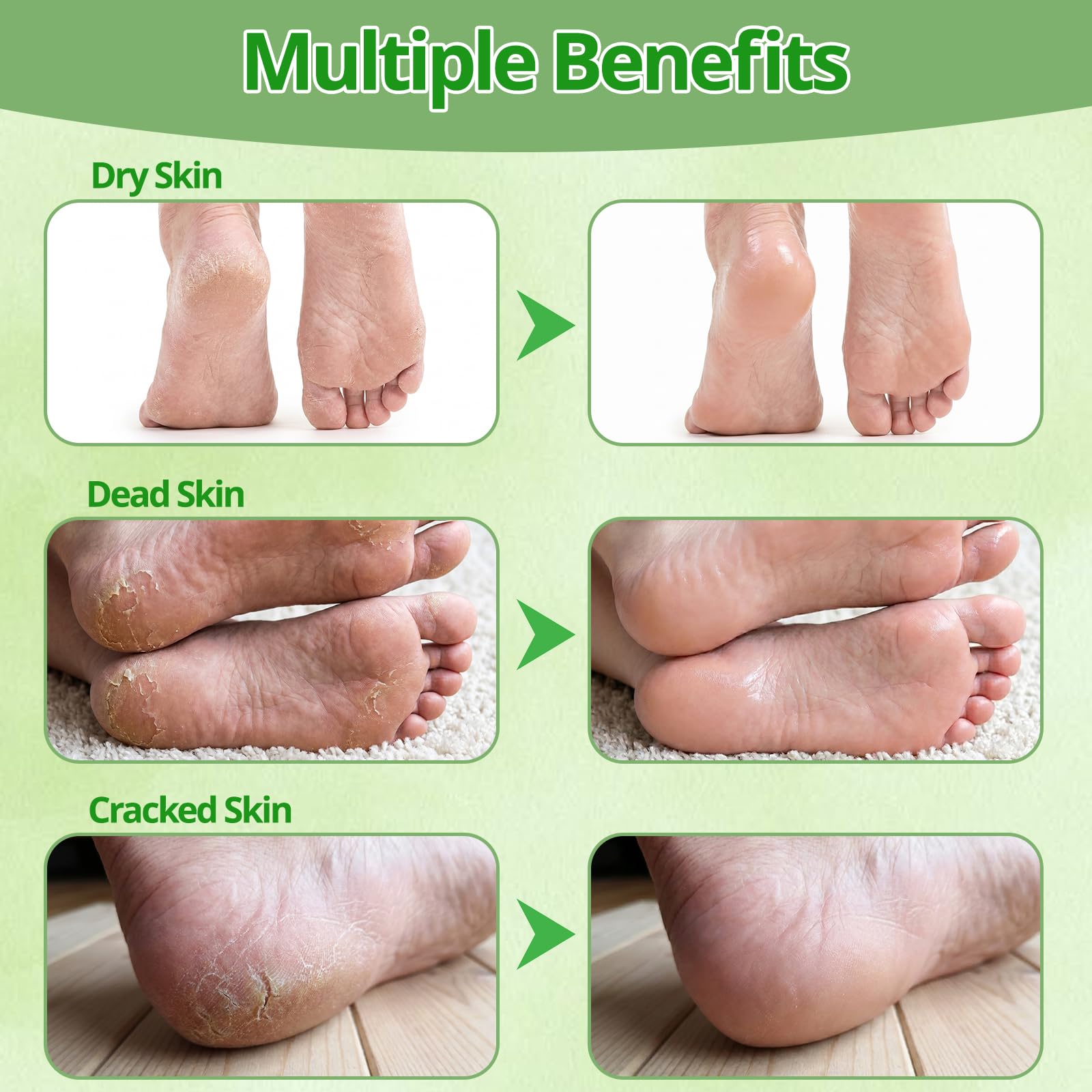 9 Pack Fußmaske Gegen Hornhaut, Hornhaut Socken für Damen Herren | Fussmaske Hornhautentfernung, Hornhautentferner Socken zur Feuchtigkeitspflege, Beruhigung(Lavendel, Aloe Vera, Avocado)
