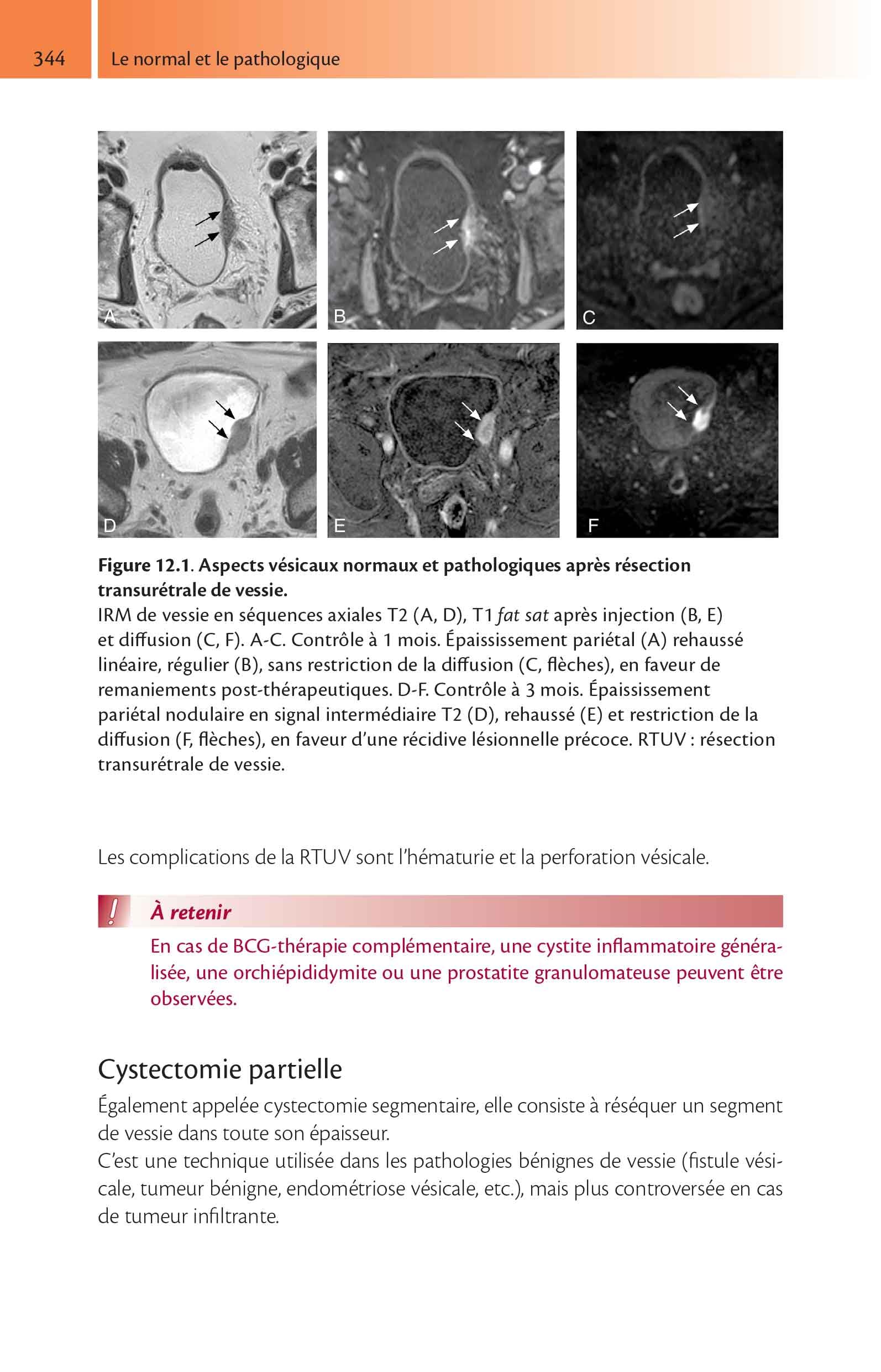 Imagerie de l'appareil urinaire de l'adulte