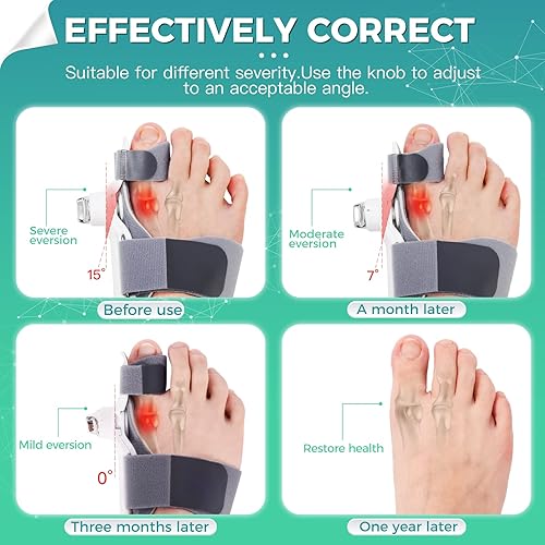 Miniatura 5 de Bunion Corrector for Women and Men Toe Separator Straightener 1PC
