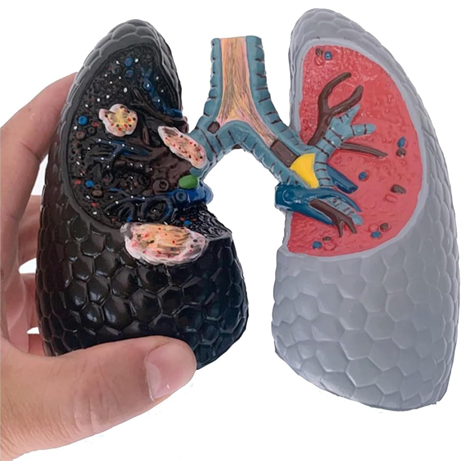 Human Health and Smoking Lung Comparison Model， Healthy vs Smoking Bronchopulmonary Anatomy with English Back Card, for Medical Teaching & Health Education Display