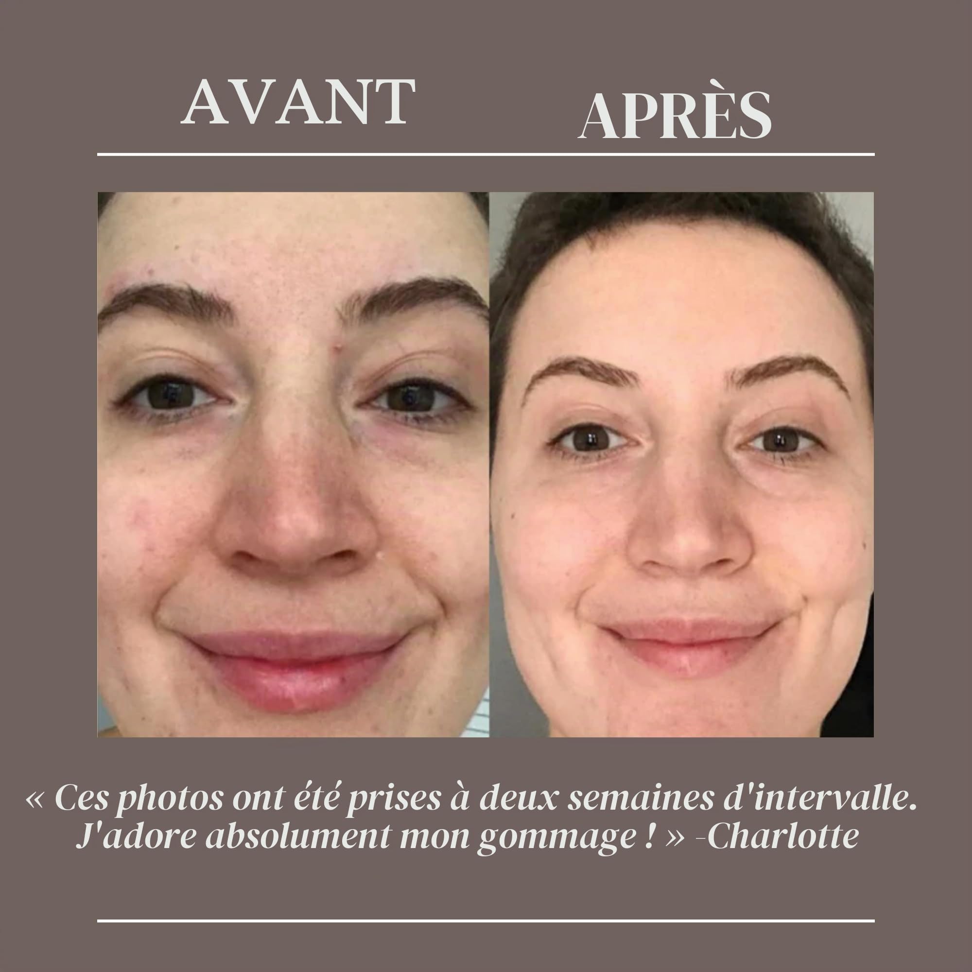 UPCIRCLE Exfoliant visage au café pour peaux sèches, naturel, végétalien, exfoliant pour le visage doux et lisse, orange, 100 ml