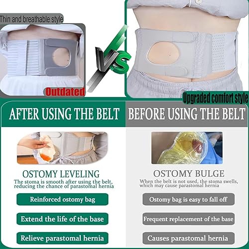 Miniatura 4 de Cinturón de soporte de ostomía ajustable para estomía, cinturón de soporte para estomía, cinturón de colostomía, proporciona protección y comodidad