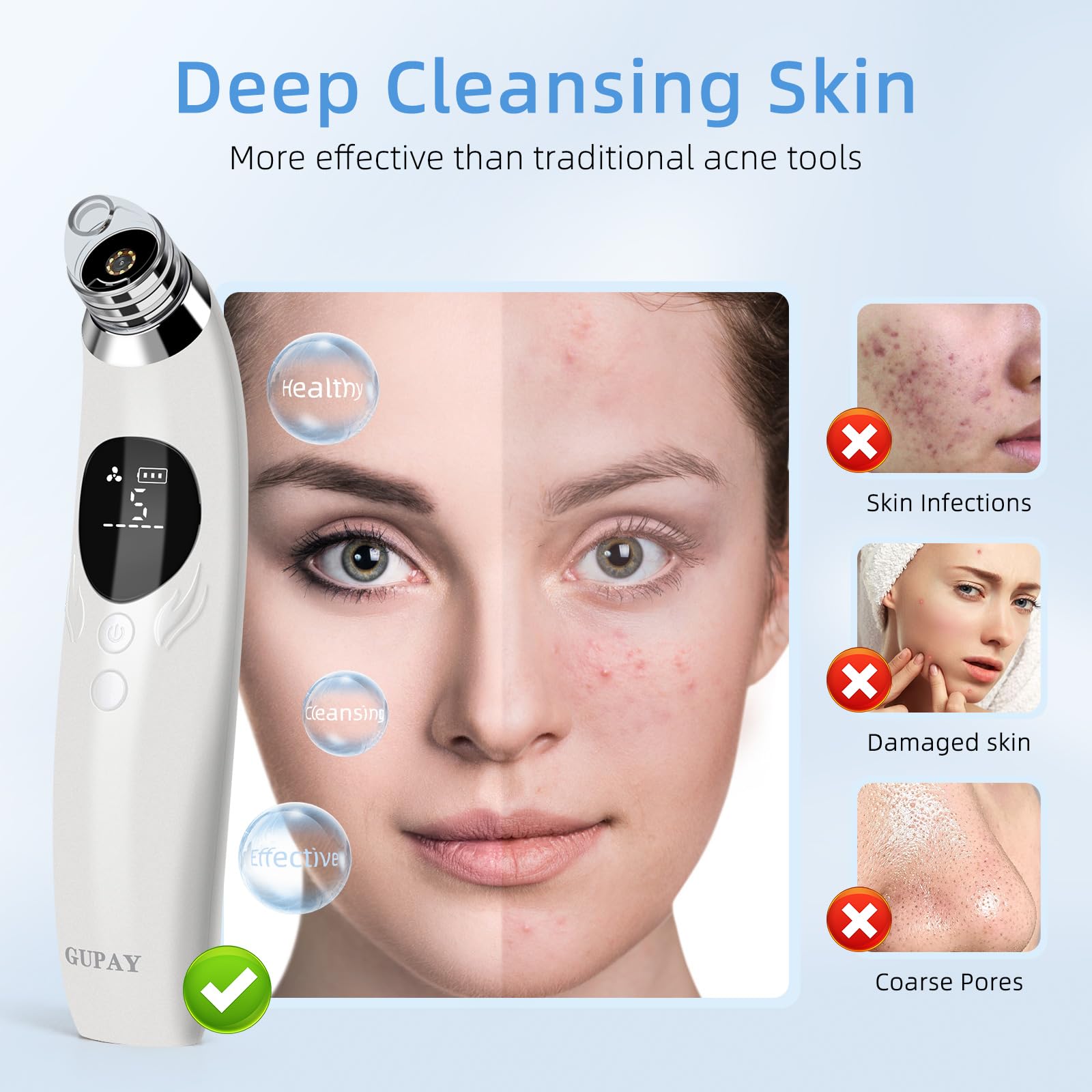 GUPAY Blackhead Remover Vacuum, Pore Vacuum with 1080p HD Camera Visible Facial Pore Cleanser with 4 Suction Heads - Image 4