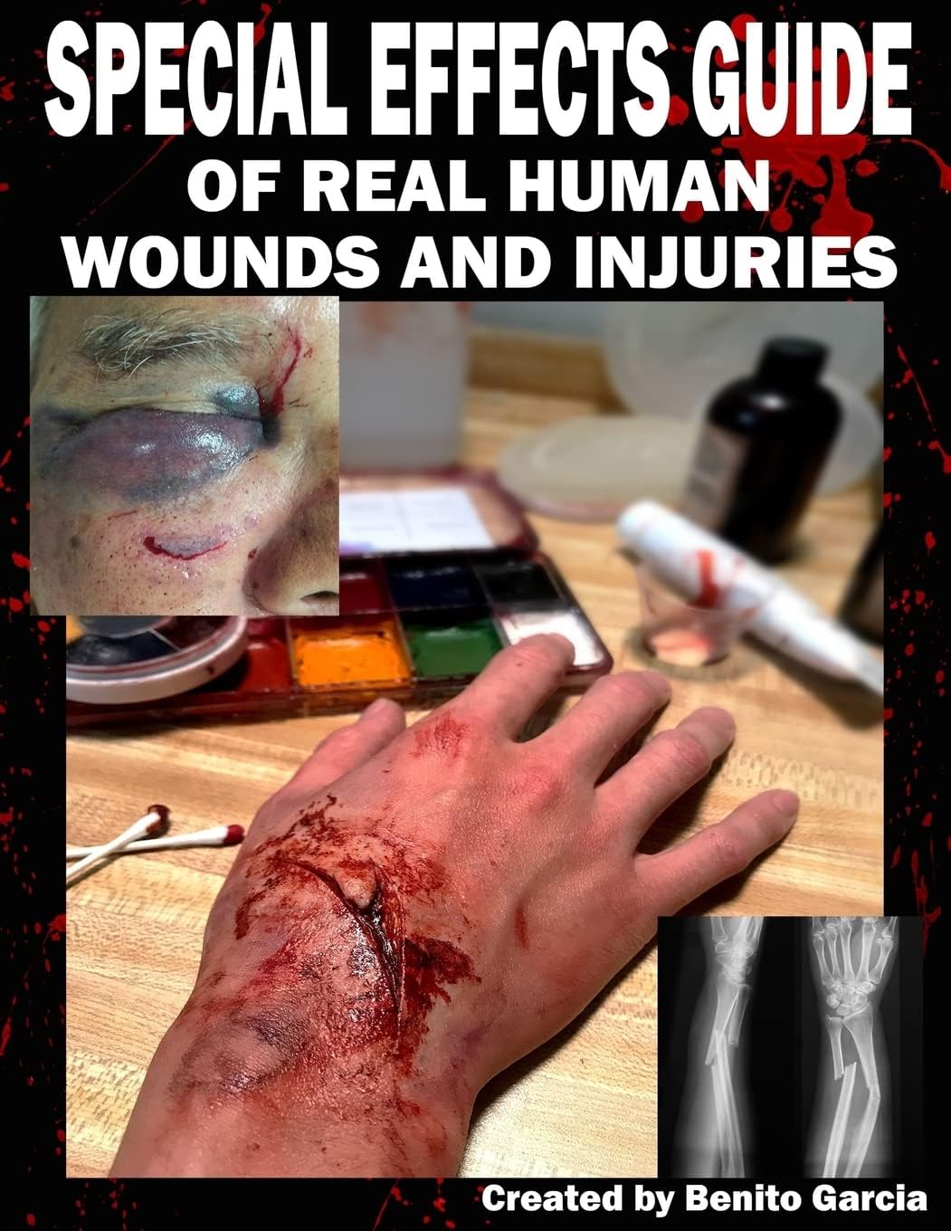 CREATESPACE Special Effects Guide Of Real Human Wounds and Injuries: Special Effects Guide Of Real Human Wounds and Injuries