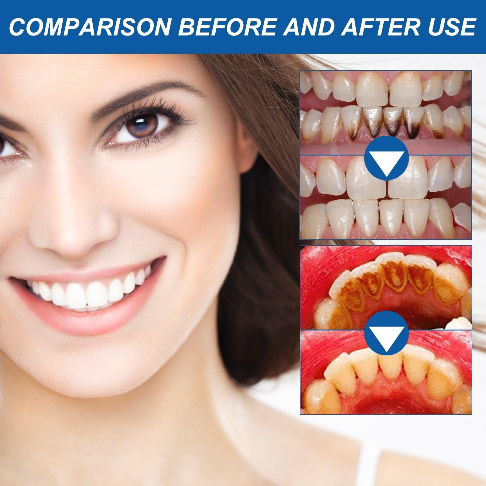 Gel sbiancante dei denti - Ripara i Gonfiori delle Gengive - Penna sbiancante dei denti, terapeutico - Dentifricio - Trattamento della recessione delle gengive - Ringiovanisci il tuo
