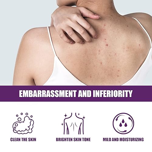 Miniatura 6 de Mub Rub Skin, Mub Rub Exfoliante, Artefacto de frotamiento de barro - Frotar barro para la piel, exfoliante exfoliante de barro, gel exfoliante de