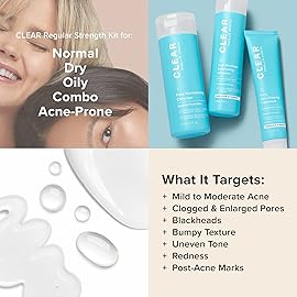 Paula\'s Choice CLEAR Regular Strength Acne Kit, 2% Salicylic Acid & 2.5% Benzoyl Peroxide for Facial Acne & Pores, Redness Relief, PACKAGING MAY VARY