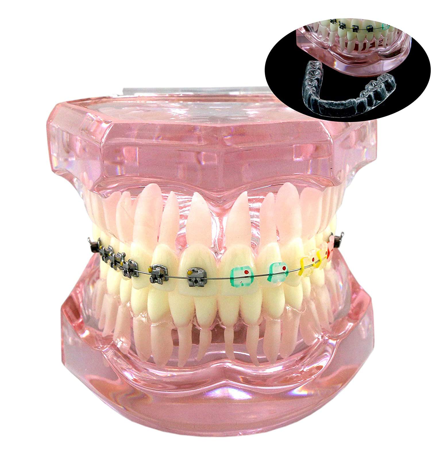 Amazon.co.jp: 歯科矯正ブラケットモデル、歯科矯正用リテーナー