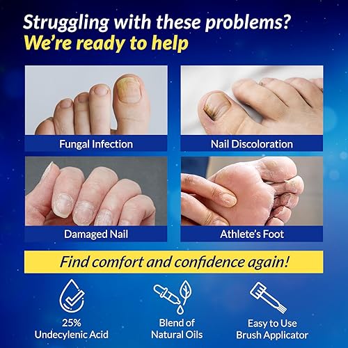 Miniatura 3 de Tratamiento de hongos en las uñas de los pies extra fuerza 25% ácido undecilénico removedor de hongos en las uñas de los dedos y dedos