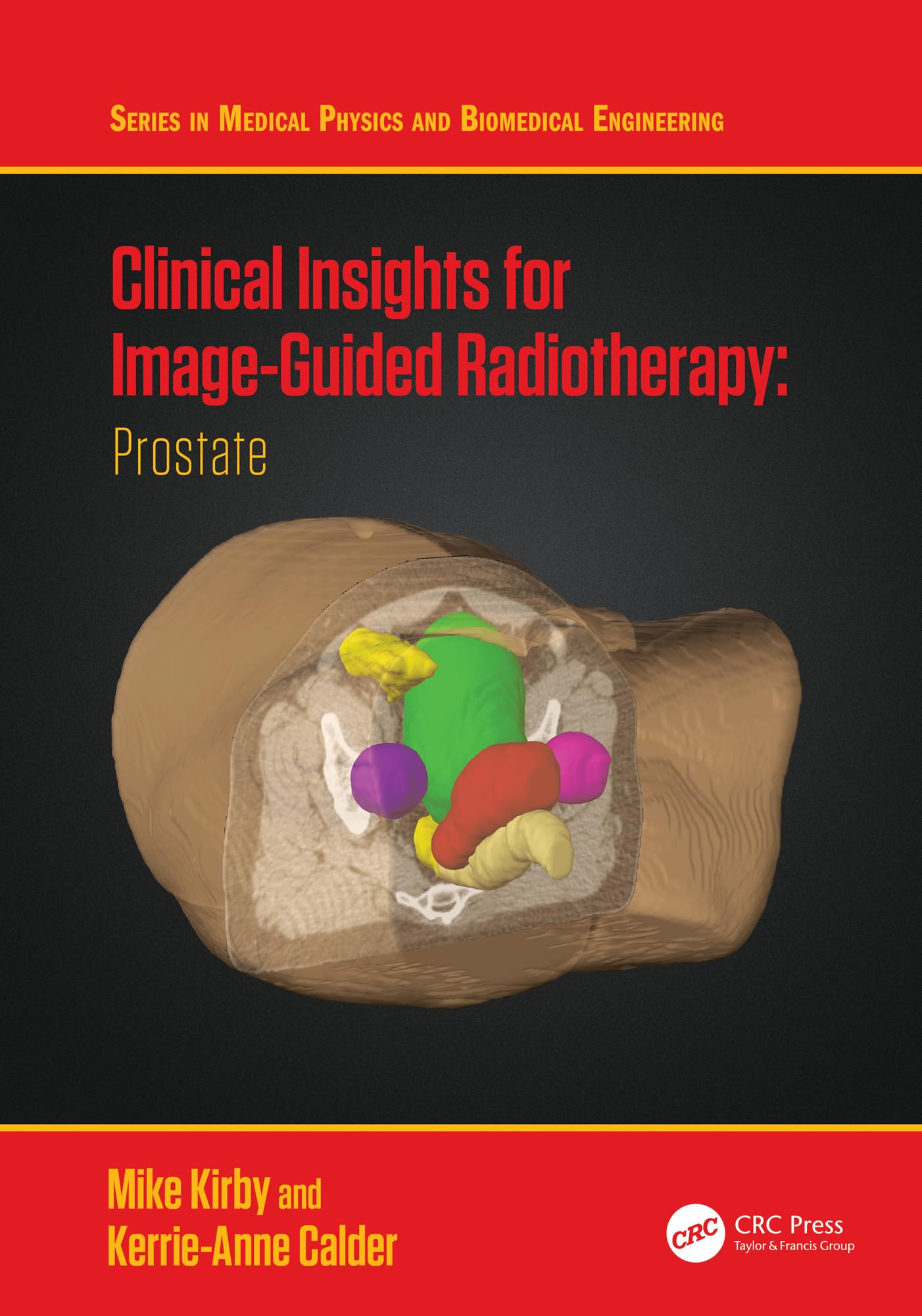 Clinical Insights for Image-Guidance Radiation Therapy: Prostate (Series in Medical Physics and Biomedical Engineering)