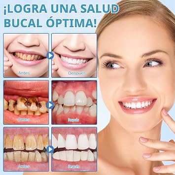 Hydroxyapatite Toothpaste 120g, Fluoride Free Toothpaste with 9.9% Nano Hydroxyapatite, Protects Tooth Enamel, Relieves Sensitivity, Strengthens Teeth, Oral Care
