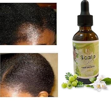 Scalp oil for massive hair growth