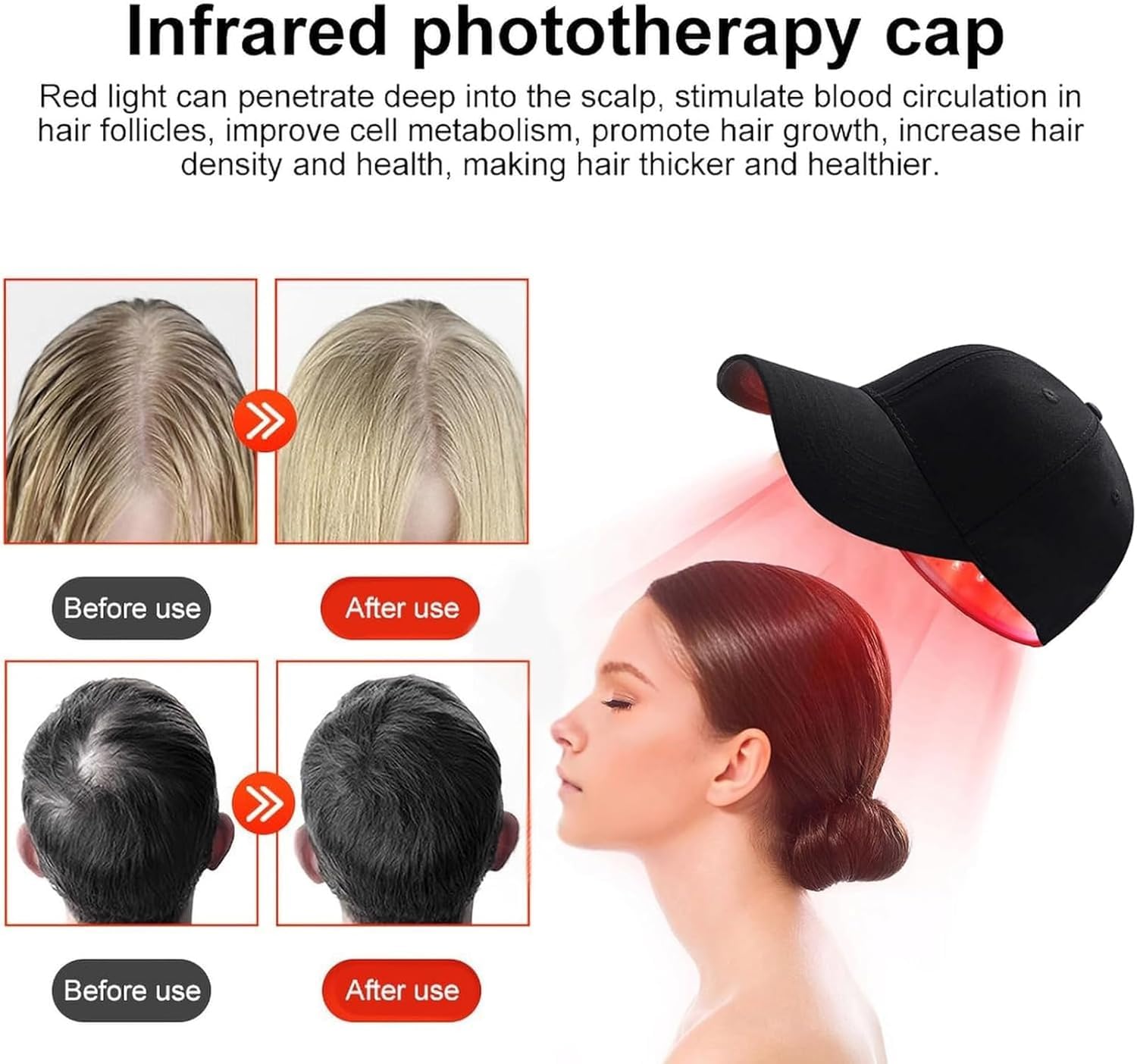 Gorro Para El Crecimiento Del Cabello Para Prevenir La Caída Del Cabello, Tratamientos Contra La Caída Del Cabello Dispositivo Para El Crecimiento Del Cabello, 82 LED, Gorro De Terapia Con Luz Roja