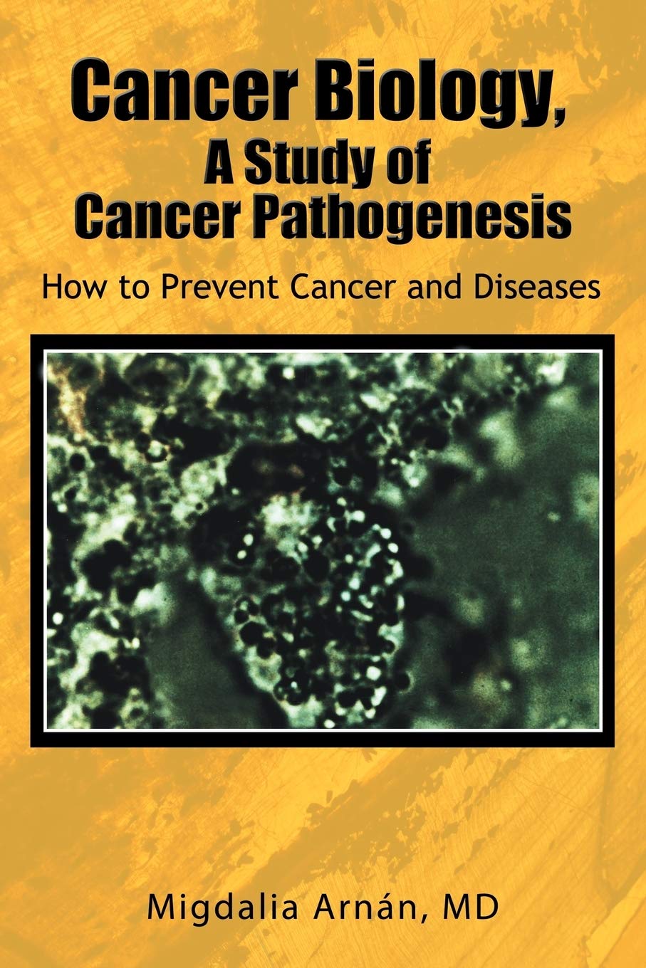 Cancer Biology, A Study of Cancer Pathogenesis: How to Prevent Cancer and Diseases