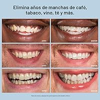 Vista 7 de Gel blanqueador Auraglow, jeringa paquete de relleno, 44% Peróxido de Carbamida, (3) Jeringas de 0.17 onzas líquidas, +30 tratamientos.