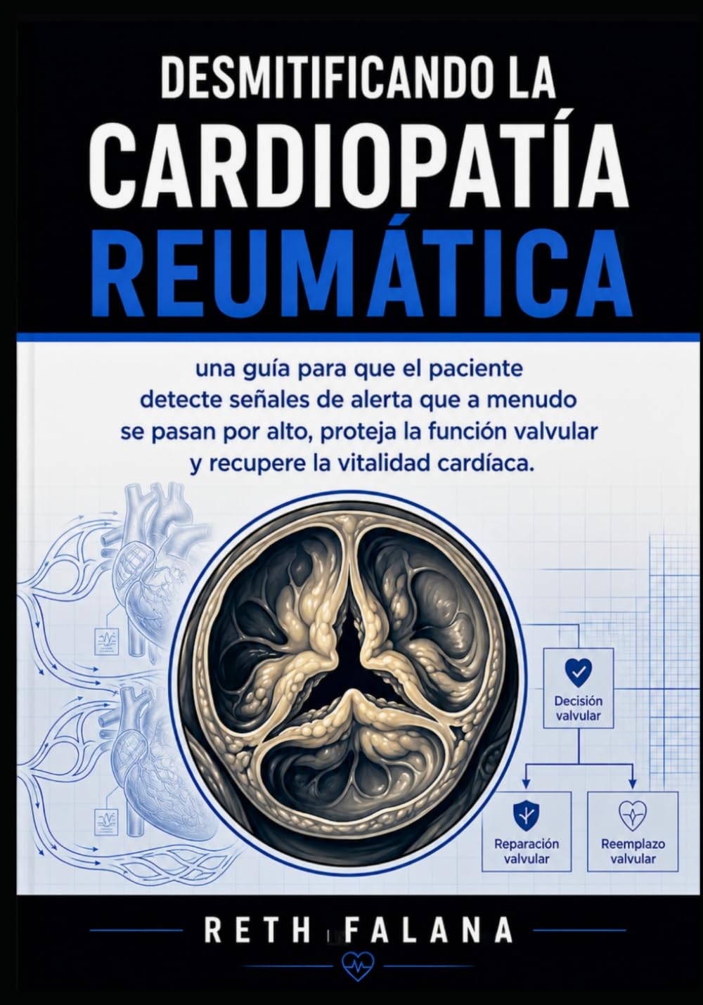 Desmitificando la cardiopatía reumática: una guía para que el paciente detecte señales de alerta que a menudo se pasan por alto, proteja la función ... Explicación de las Afecciones Cardíacas)