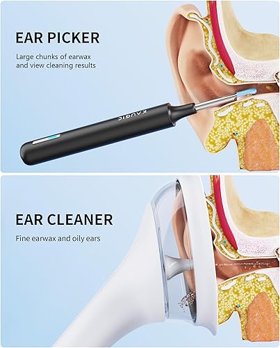 Miniatura 3 de Cámara con herramienta de eliminación de cera de oído Sistema de enjuague de riego de oídos elegible por FSAHSA y limpiador de oídos con cámara