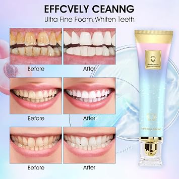 2PCS Niacinamide Whitening Toothpaste, Niacinamide Toothpaste | Whitening Teeth, Fresh Breath, Remove Tooth Stains