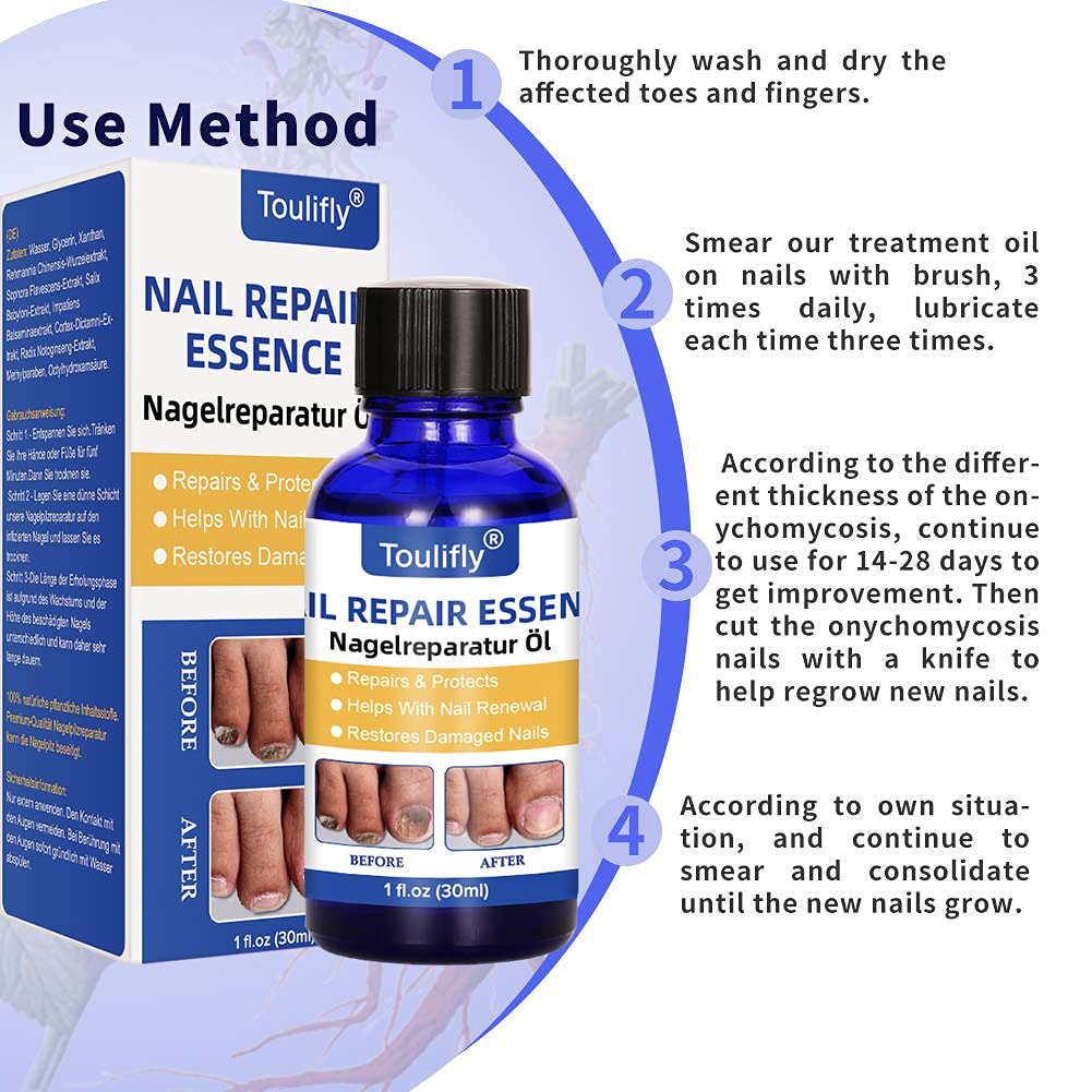 Nail Repair, Fingernail and Toenail Repair, Maximum Strength Nail Solution, Repairs and Protects Toenail and Fingernail from Discoloration, Brittle and Crack : Everything Else