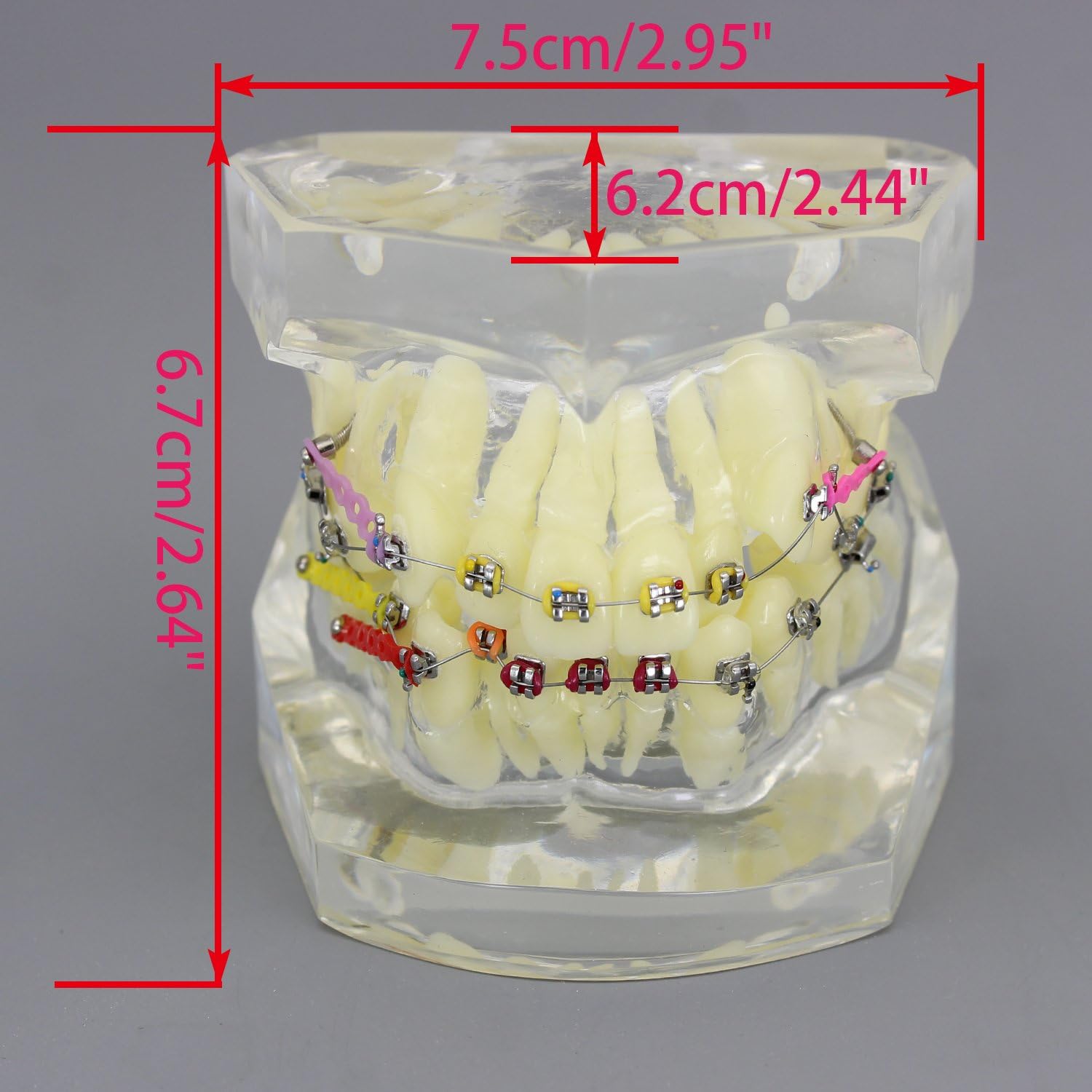 Dental Malocclusion Orthodontic Treatment Teeth Model with Metal Brackets Wires Colorful Ties Chains and Hoops M3005