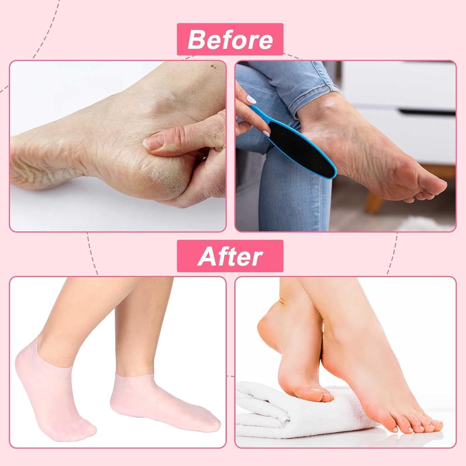 Dadhichi Zone 1pcs Silicone Moisture Socks– Non-Slip Gel Socks for Dry Cracked Feet, Softening Foot Care Socks for Women (Multicolor) 3