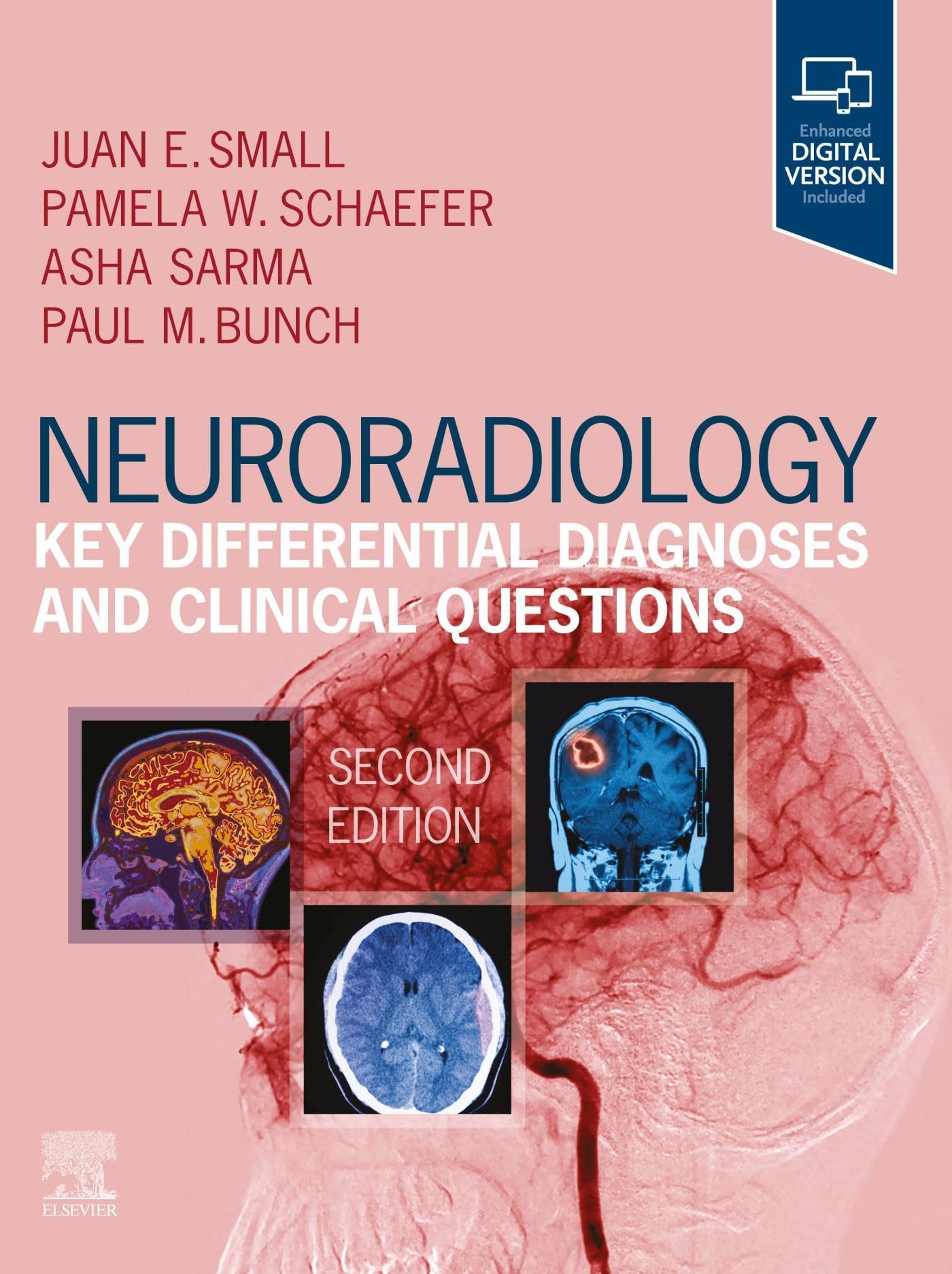 Neuroradiology: Key Differential Diagnoses and Clinical Questions E-Book (English Edition)