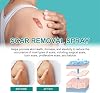 Scar Remove Scar Remove Medical Grade Scar Spray Scar Removal Spray Acne Scar Treatment for Face Acne Scars and Dark Spaot Remover Gentle Skin Care for Acne Prone Skins (2 Pieces)