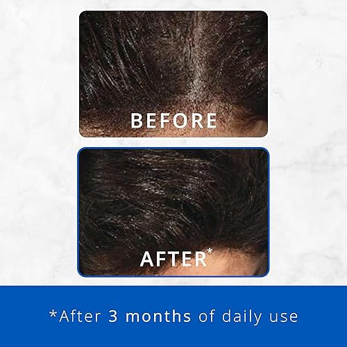 Miniatura 4 de Skin Research Laboratories Fórmula potenciadora NeuHair, 2.7 Fl Oz