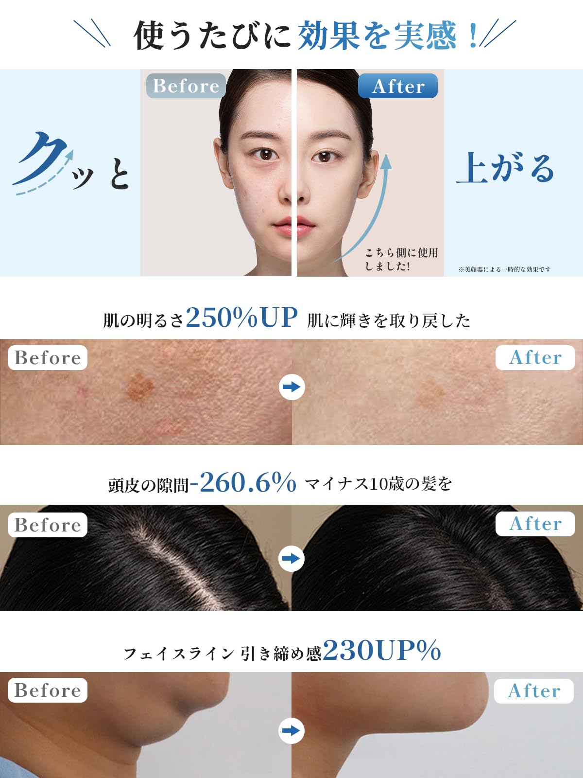 電気ブラシ (電動 頭皮ブラシ 美顔器 頭皮 フェイス ボディ 小顔 Amazon | 電気ブラシ 頭皮ブラシ マイナスイオン 青/赤/紫LED光