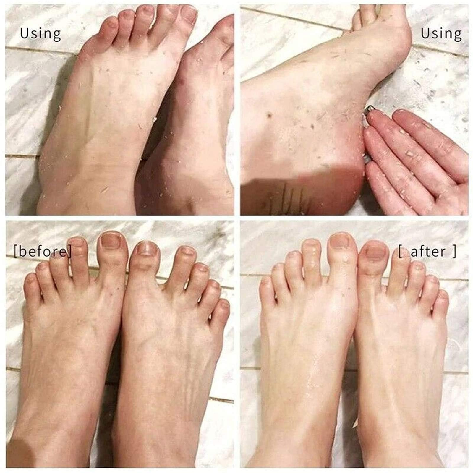 Spray peeling istantaneo per i piedi, maschera per i piedi per staccare la pelle morta, rimuovono la pelle morta in pochi secondi, peeling esfoliante e calli sui piedi
