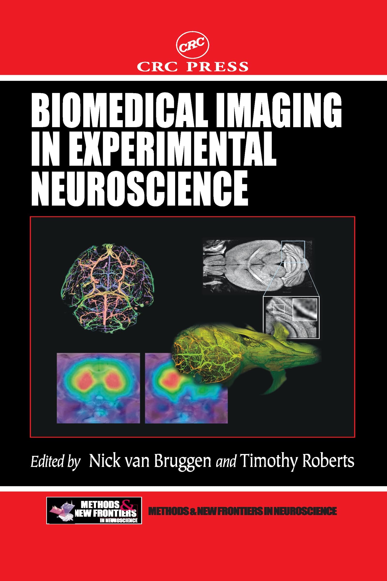 Biomedical Imaging in Experimental Neuroscience (Frontiers in Neuroscience)
