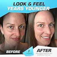 Vista 2 de Colágeno en polvo para mujeres y hombres (5 libras) Tipos I y III sin sabor, fácil de mezclar, péptidos de proteína hidrolizada sin OMG, alimentados