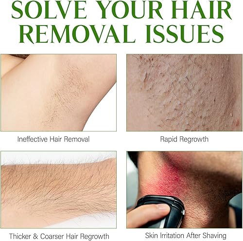 Miniatura 8 de Aceite Cyperus Rotundus, aceite Cyperus Rotundus para depilación, Cyperus Oi-l Natural, calmante y suave, reduce el crecimiento del vello corporal,